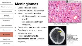 Nervous System Tumors [upl. by Huoh]